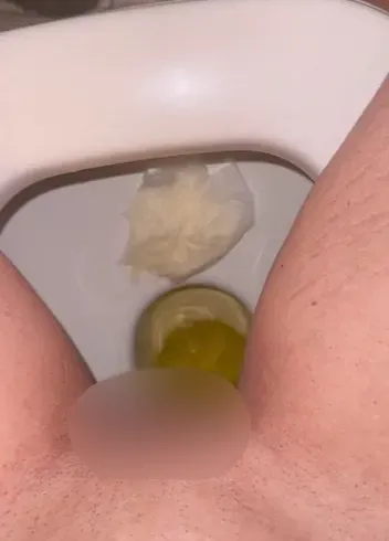 Willst du lieber das vollgepisste Toilettenpapier sein oder das was mich sauber macht?