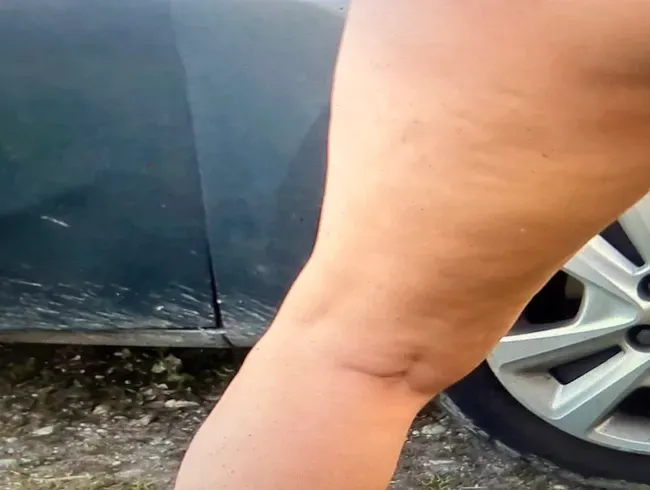 Im Wald dringend pissen müssen