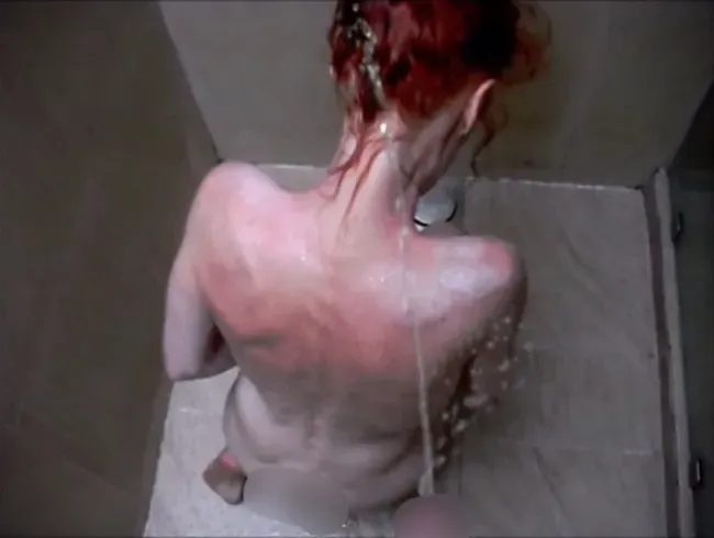 Er wollte meinen Sonnnenbrand mit Pisse kühlen !